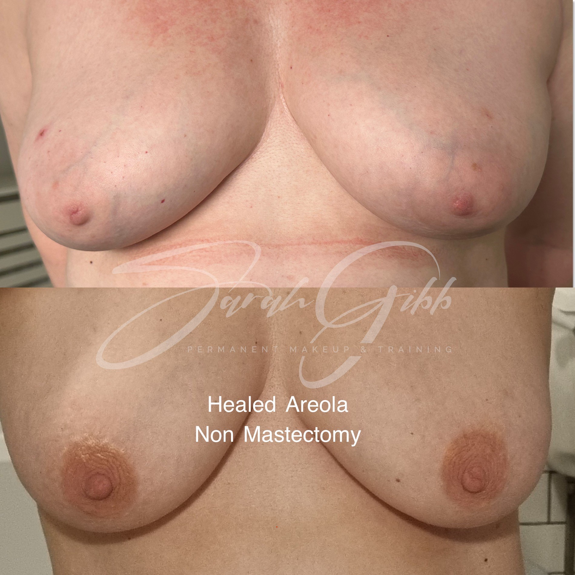 Healed Areola with added colour, non mastectomy. Done by Sarah Gibb UK